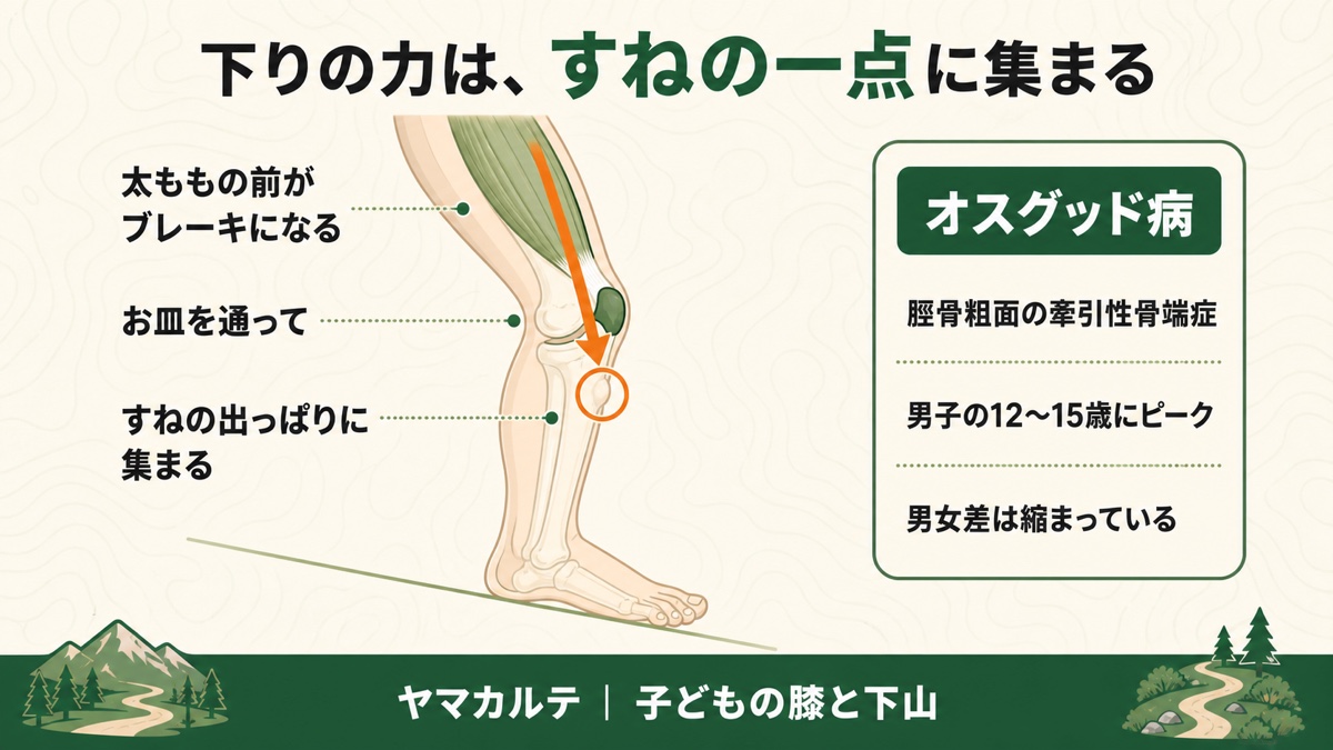 下りの力が太ももの前からお皿を通ってすねの出っぱりに集まることを示す図解 脛骨粗面の牽引性骨端症がオスグッド病で男子の12〜15歳にピークがあり男女差は縮まっている ヤマカルテ